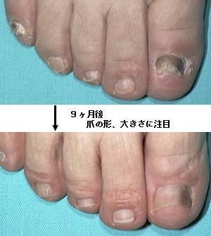 こんな症状 解説